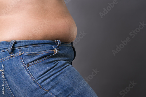 Fototapeta Naklejka Na Ścianę i Meble -  Woman with fat abdomen in blue jeans, overweight female stomach, stretch marks on belly closeup