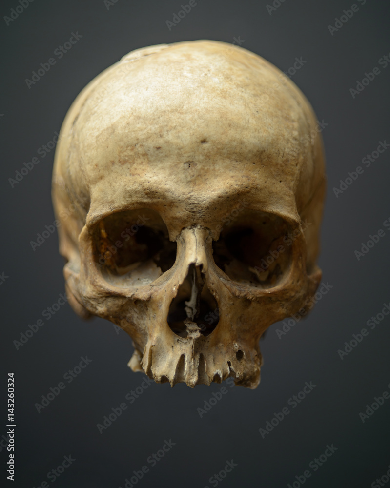 Decaying Skull (crâne abimé par le temps) Decaying Skull (crâne abimé par le temps)