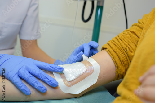 Plaster being applied over patient's arm photo