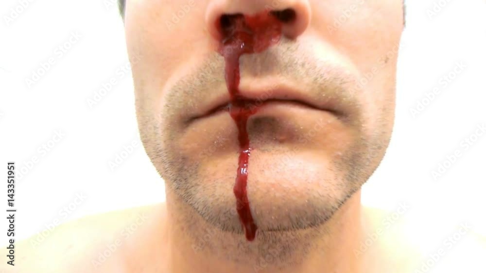 Man's nose bleeding with zoom in effect.