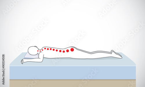 Wrong sleeping position make incorrect spinal alignment. Illustration about relax for good health.