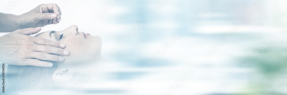 Ταπετσαρία Relaxed woman receiving an acupuncture treatment
