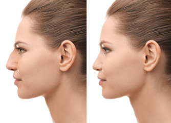Young beautiful woman on white background. Plastic surgery concept