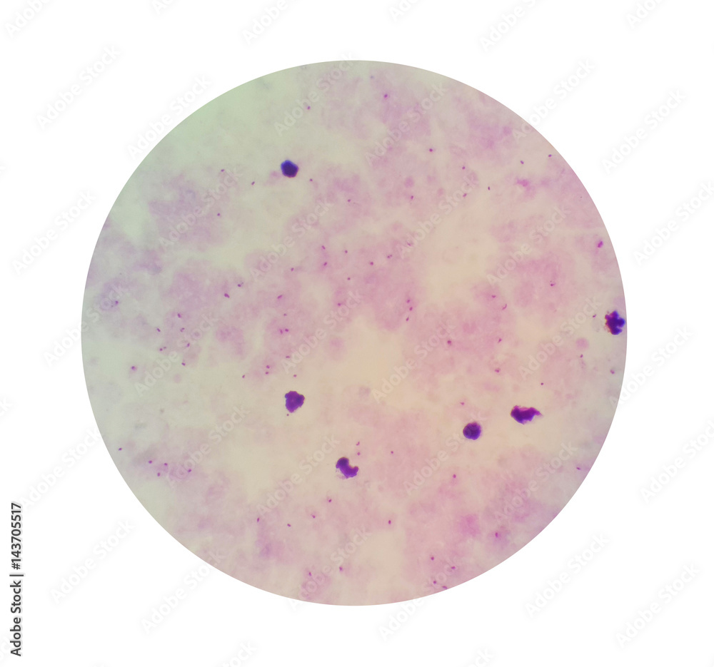 Malaria Parasite Under Microscope