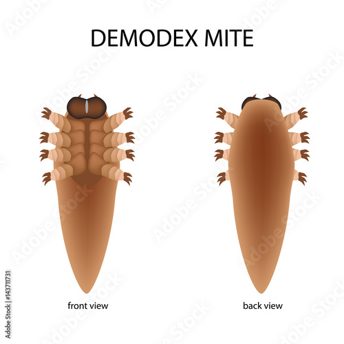 The structure of the demodex mite. Front view and rear view. Demodecosis. Infographics. Vector illustration on isolated background.