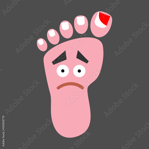 Unhappy leg with cut off nail Podiatry medical concept. Human feet anatomy. Vector illustration