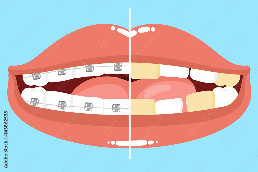 cute cartoon mouth cute cartoon mouth