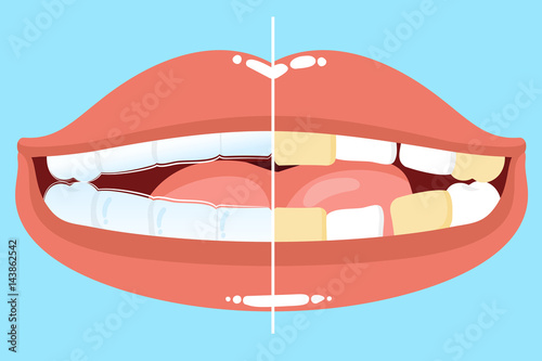 cute cartoon mouth
