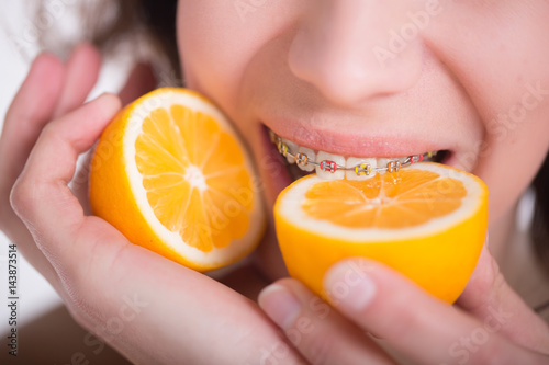 Girl with multi-colored braces tastes a lemon