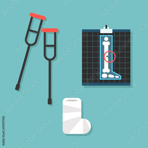 Broken leg conceptual set crutches, x-ray image and cast bandage