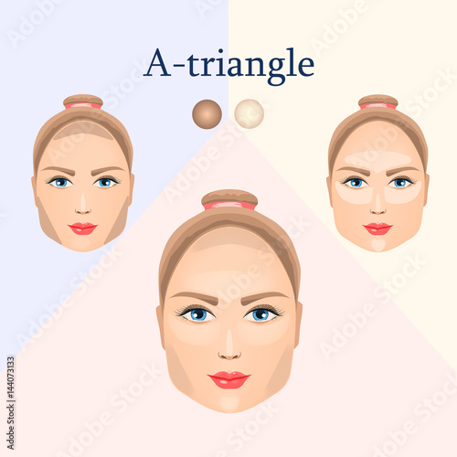 Correction for the A-triangular face