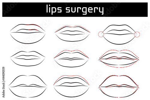 Set of Lips tips. Vector Illustration.