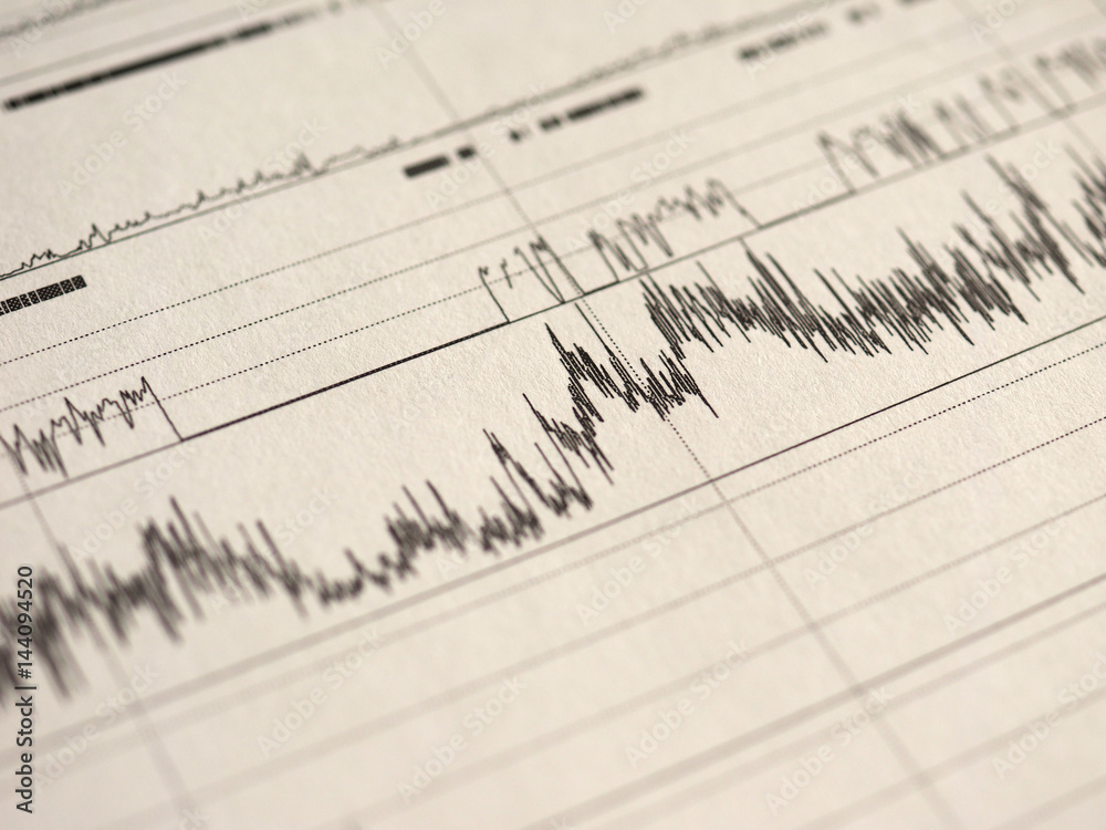Fototapeta premium polysomnography (PSG) sleep study