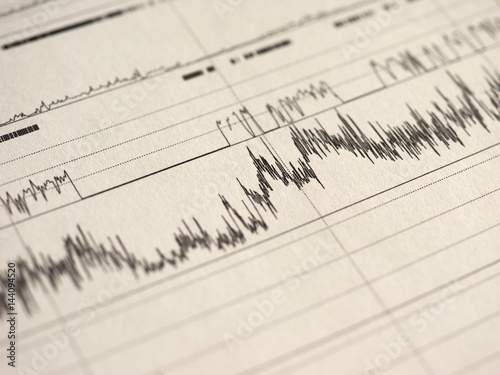 polysomnography (PSG) sleep study