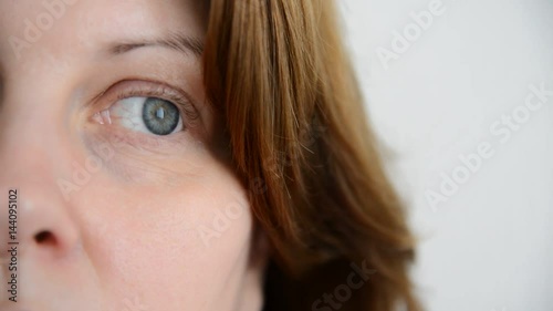 The nervous tic of lower eyelid in a woman