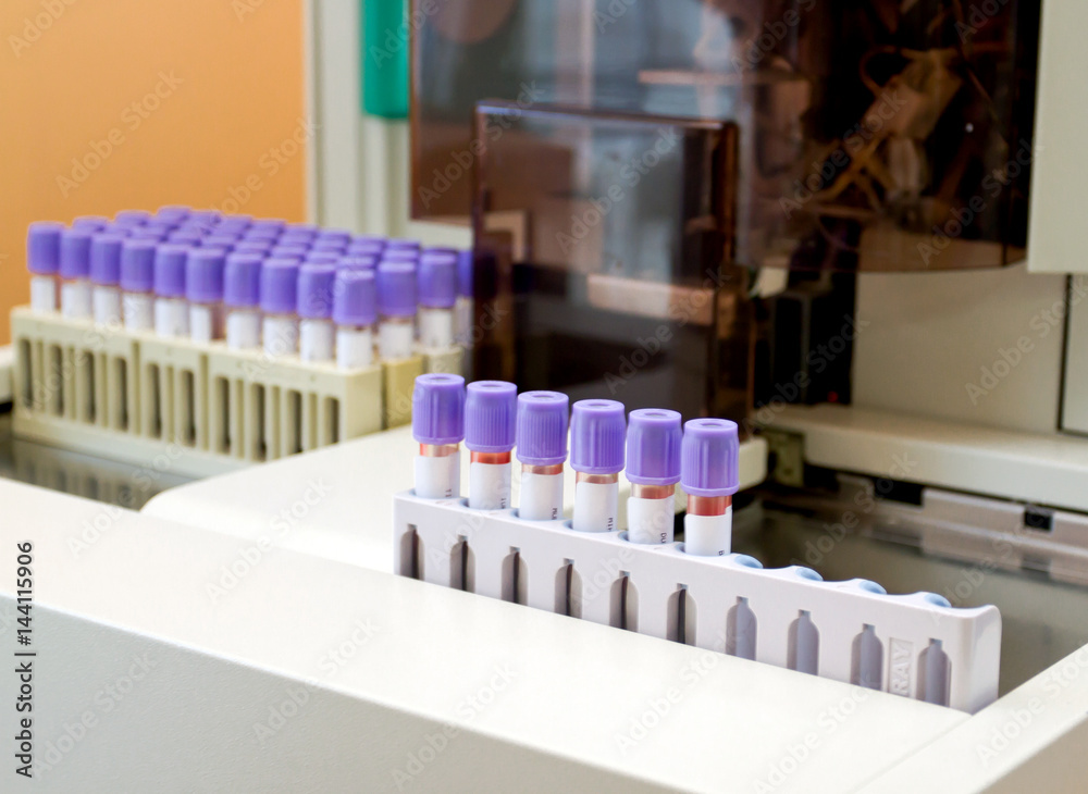 Test tubes for lab, isolated. Close-up of test tubes arranged on a tray in medical laboratory.