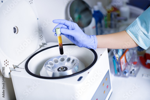 Plasmolifting. Preparation of blood for injections. cosmetologist puts tube of blood in centrifuge