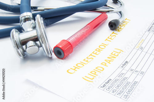 Cholesterol test (lipid panel) analysis result, test tubes with blood and a medical stethoscope lies on table. Concept of diagnosis atherosclerosis in patient with high level cholesterol in blood test
