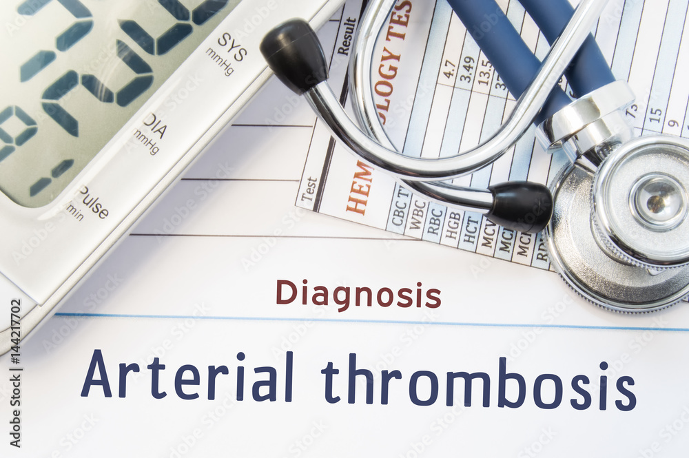 Diagnosis Arterial thrombosis. Stethoscope, hematology blood test