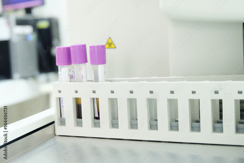 test tube cbc lab