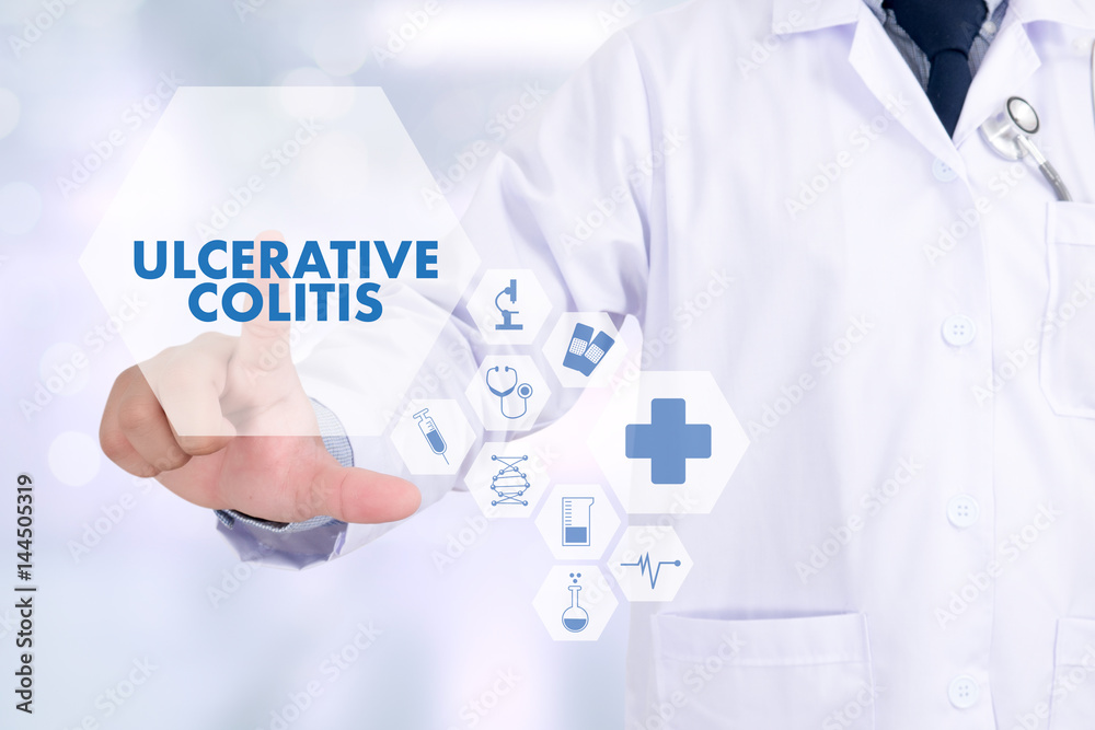 ULCERATIVE COLITIS Healthcare modern medical Doctor concept ULCERATIVE COLITIS Healthcare modern medical Doctor concept