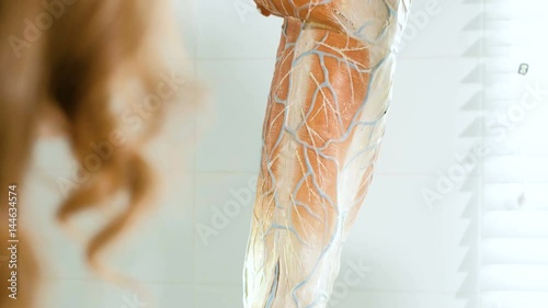 The doctor in the clinic of surgical venous vascular surgery shows on the breadboard model of the leg to the patient 4k