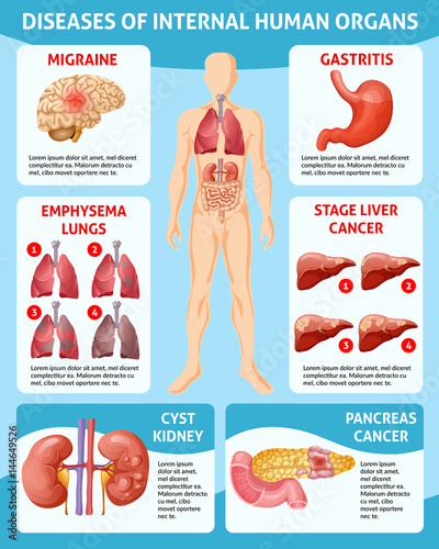 Cartoon Medical Care Infographic Concept