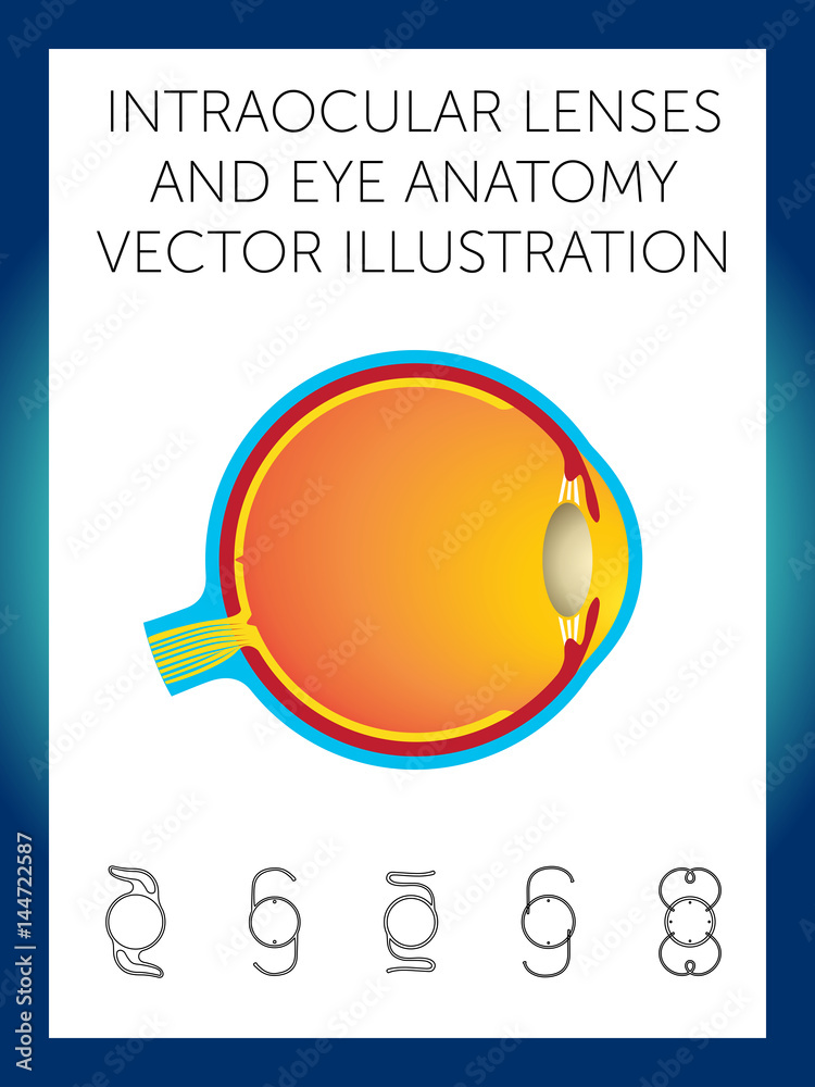 intraocular lenses and eye anatomy vector illustration Stock Vector ...