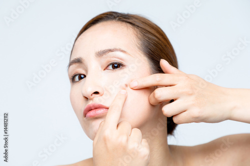 young woman squeezing a pimple, beauty and skincare concept