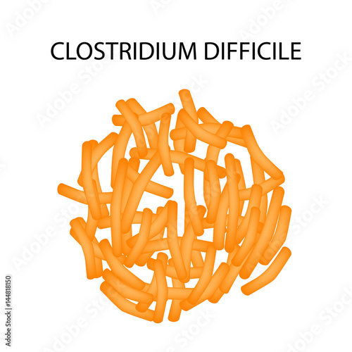 Clostridium difficile. Pathogenic flora. The bacterium causes intestinal diseases. Infographics. Vector illustration.