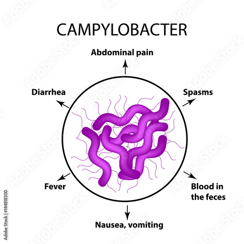 Campylobacter. Pathogenic flora. The bacterium causes intestinal diseases. Symptoms of infection. Infographics. Vector illustration. photo