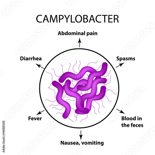Campylobacter. Pathogenic flora. The bacterium causes intestinal diseases. Symptoms of infection. Infographics. Vector illustration.