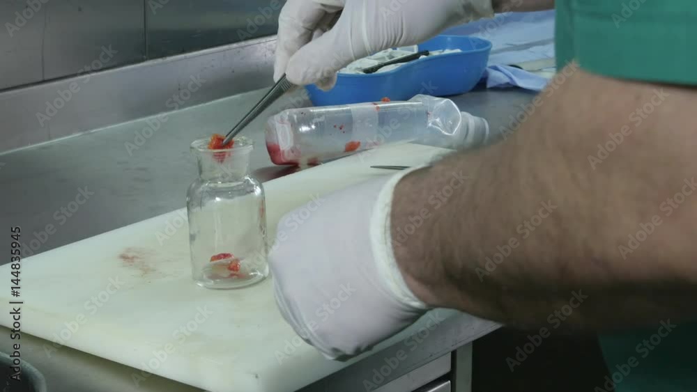 Pathologist using knife for cutting tissue sample of a patient, hands close up Pathologist using knife for cutting tissue sample of a patient, hands close up
