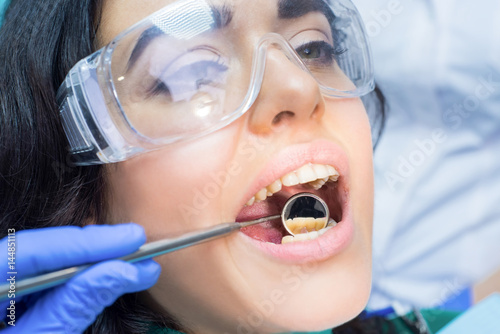 Photos Stomatologist is using concave mirror