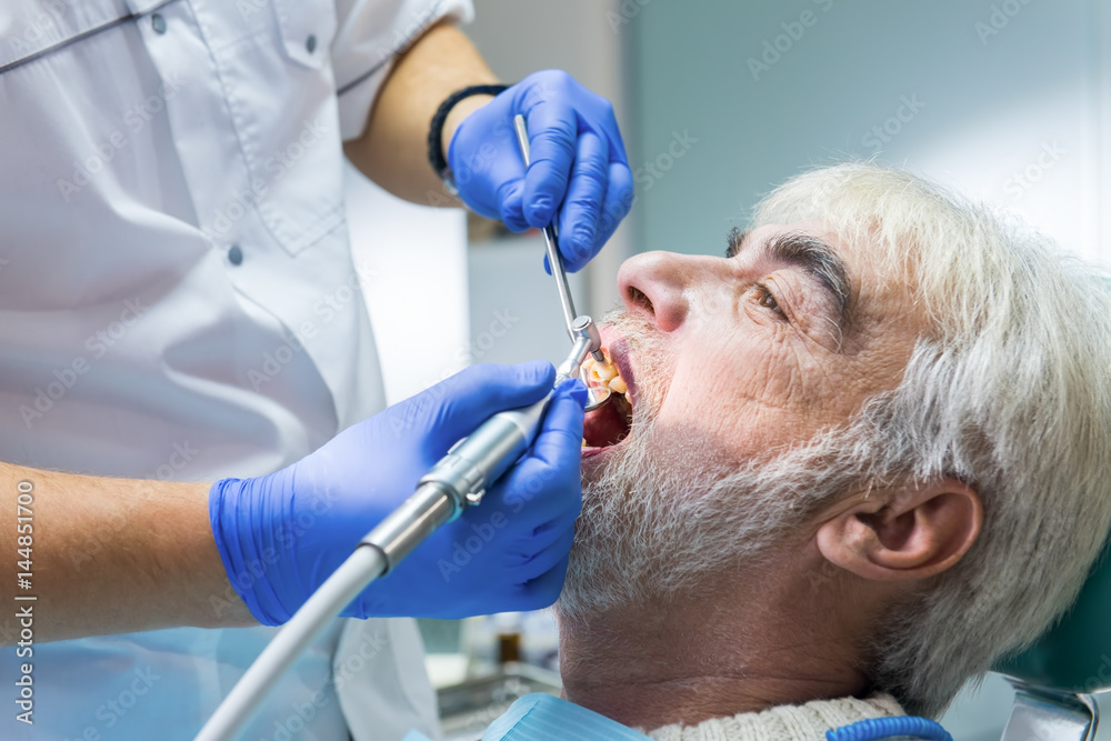 Stomatologist cleaning teeth. Hands of dentist working. Stomatologist cleaning teeth. Hands of dentist working.