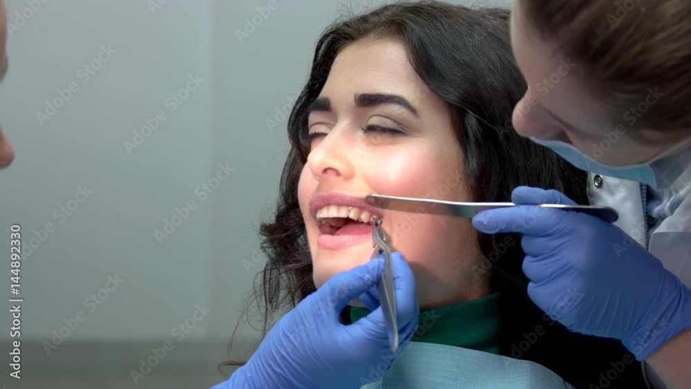 Dentists installing teeth braces. Doctor holding a spatula. Types of dental brackets. Dentists installing teeth braces. Doctor holding a spatula. Types of dental brackets.