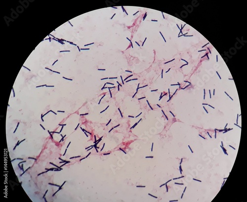 Smear of human blood culture Gram's stained with gram positive bacilli bacteria, under 100X light microscope.