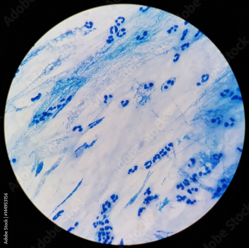 Smear of Acid-Fast bacilli (AFB) stained from sputum specimen, under 100X light microscope. photo