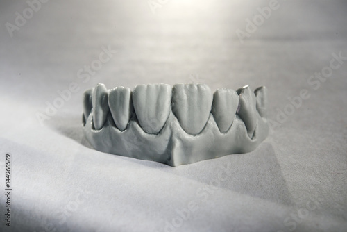 Stomatology. Cast of human jaw made of polymer photo