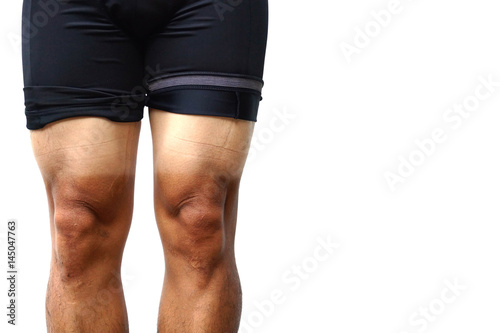Sunburn. Mountain bike cyclist with massive sunburn on his legs isolated on white with copy space to add text © weerapat1003