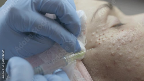 Close-up of the cosmetologist doing botox injections for the client in the beauty salon,  slow motion