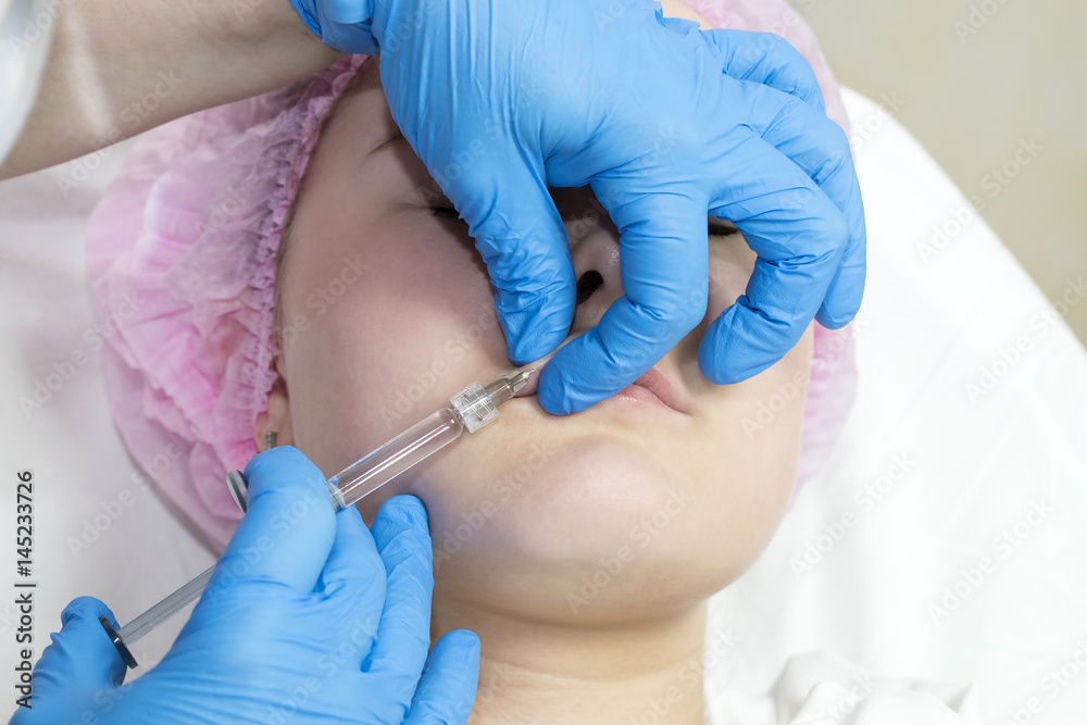 The process of cosmetic surgery of water injection in the area of the lips of a woman The process of cosmetic surgery of water injection in the area of the lips of a woman