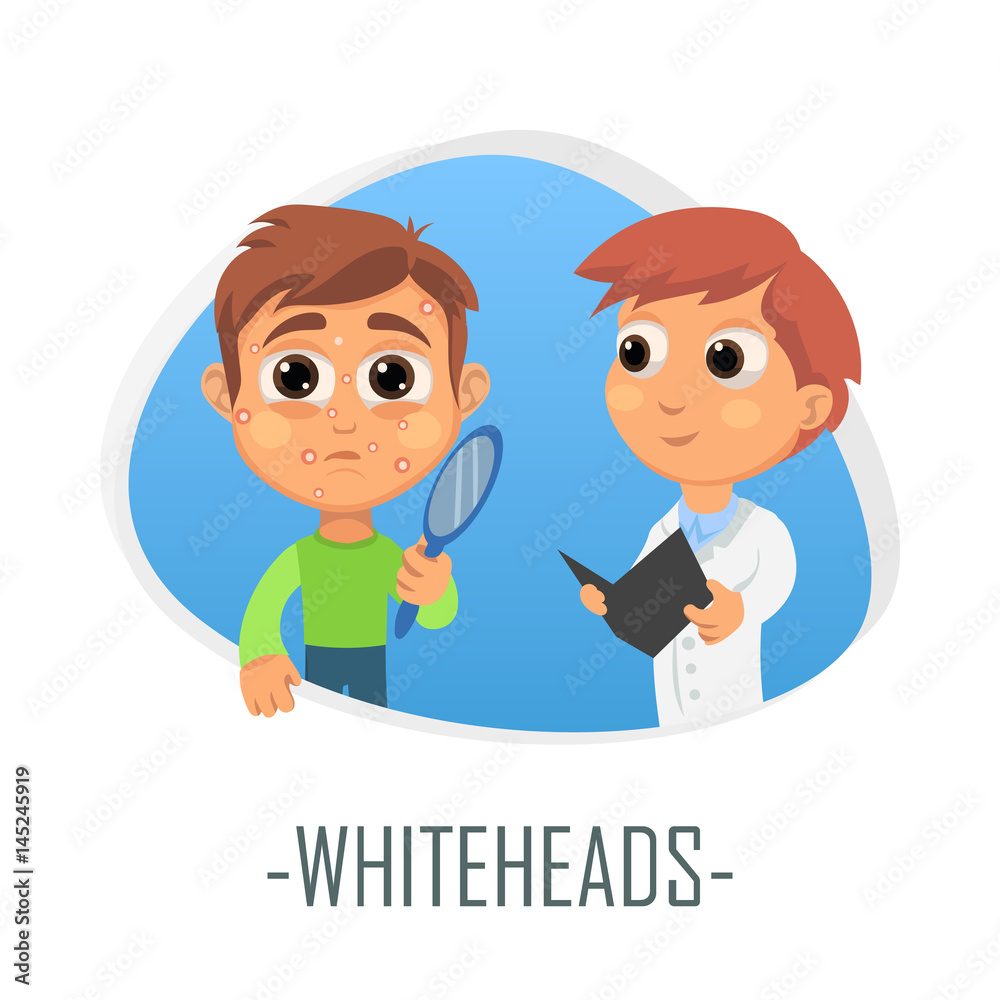 Whiteheads medical concept. Vector illustration. Whiteheads medical concept. Vector illustration.