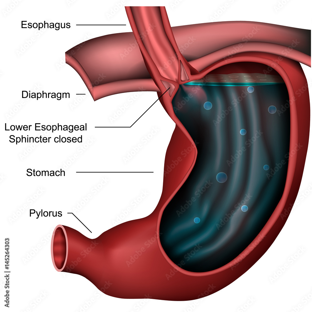 Healthy stomach and esophageal sphincter with description in