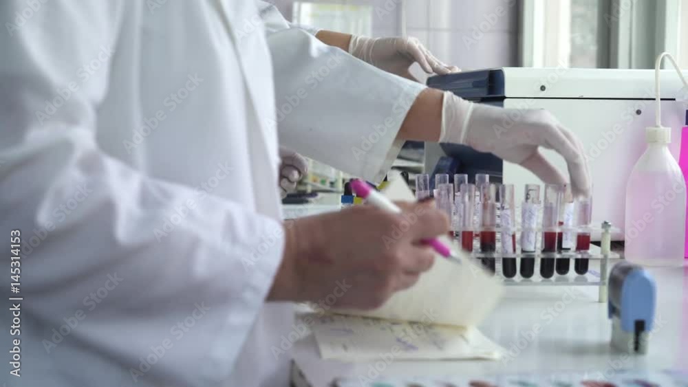 Realistic scene of laboratory blood analysis, technicians using test tubes with samples, holding hands close up, shallow depth of field, indoors, dolly shot Realistic scene of laboratory blood analysis, technicians using test tubes with samples, holding hands close up, shallow depth of field, indoors, dolly shot