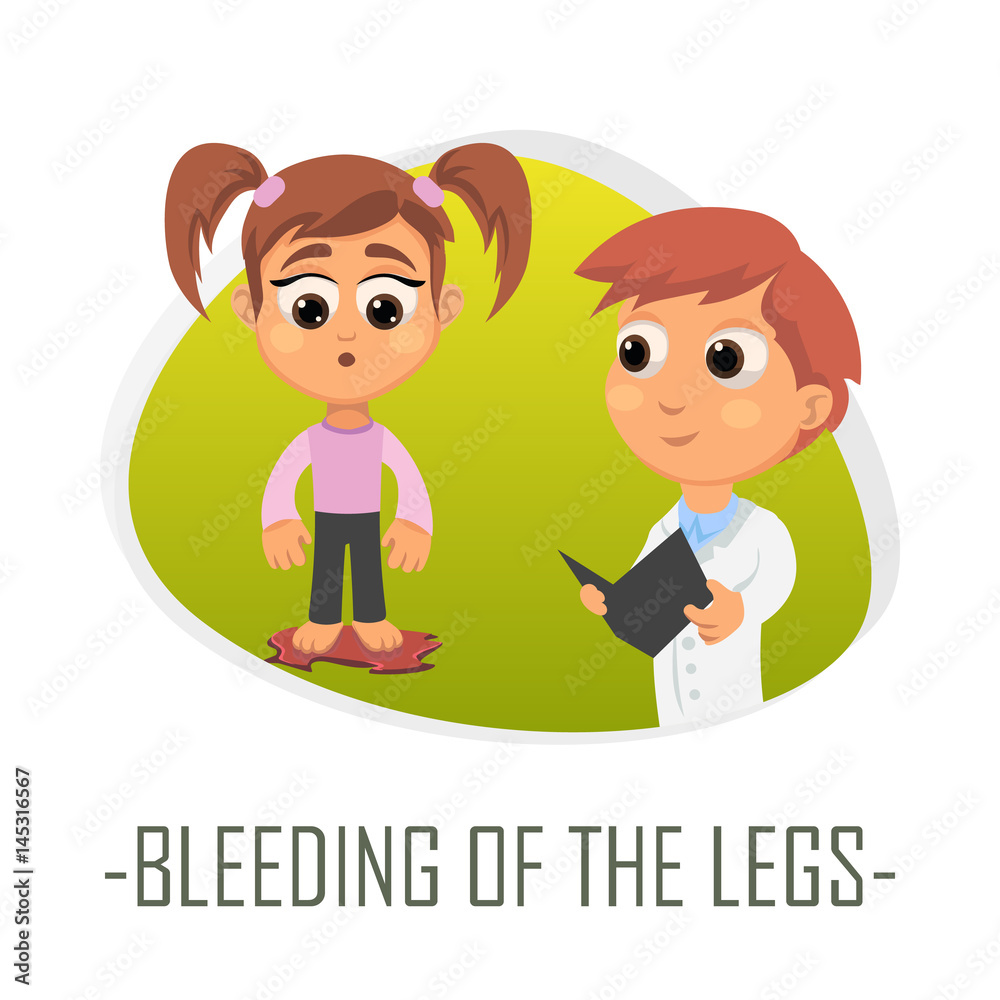 Bleeding of the legs medical concept. Vector illustration. Bleeding of the legs medical concept. Vector illustration.