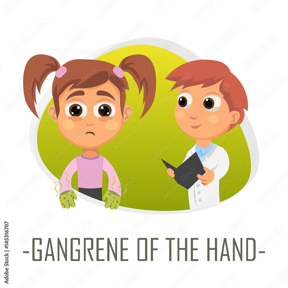 Gangrene of the hand medical concept. Vector illustration. Gangrene of the hand medical concept. Vector illustration.