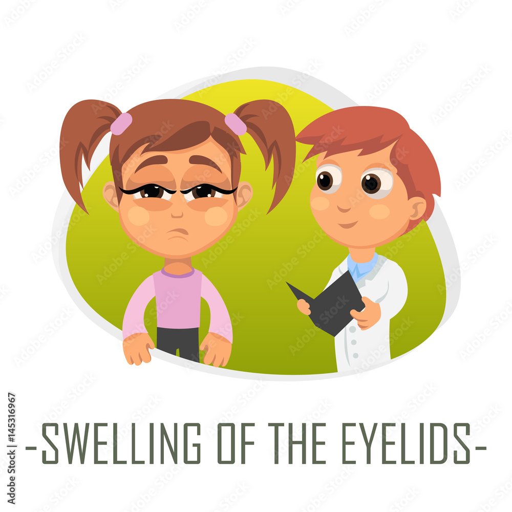 Swelling Of the eyelids medical concept. Vector illustration. Swelling Of the eyelids medical concept. Vector illustration.