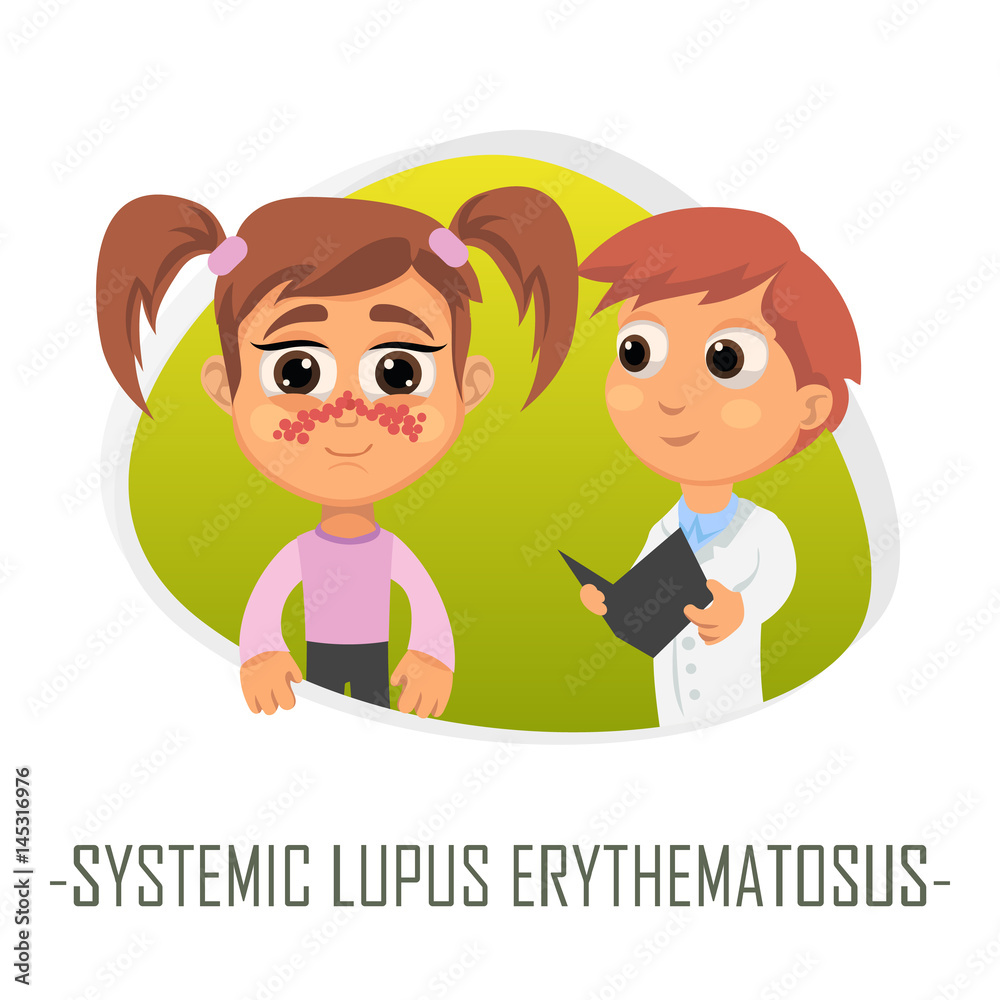 Systemic lupus erythematosus medical concept. Vector illustration.