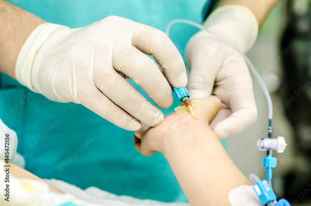 Setting up a peripheral catheter to monitor invasive blood pressure. Setting up a peripheral catheter to monitor invasive blood pressure.
